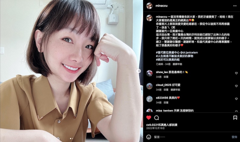 馬來西亞許小姐在台灣完成陶瓷貼片治療後，開心在網路上分享美麗笑容和推薦心得